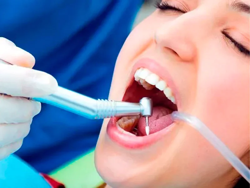 Endodoncia