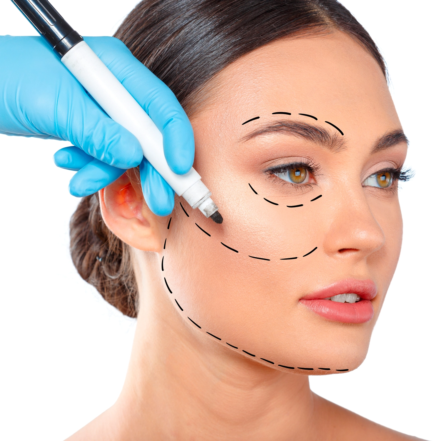 Estética Orofacial