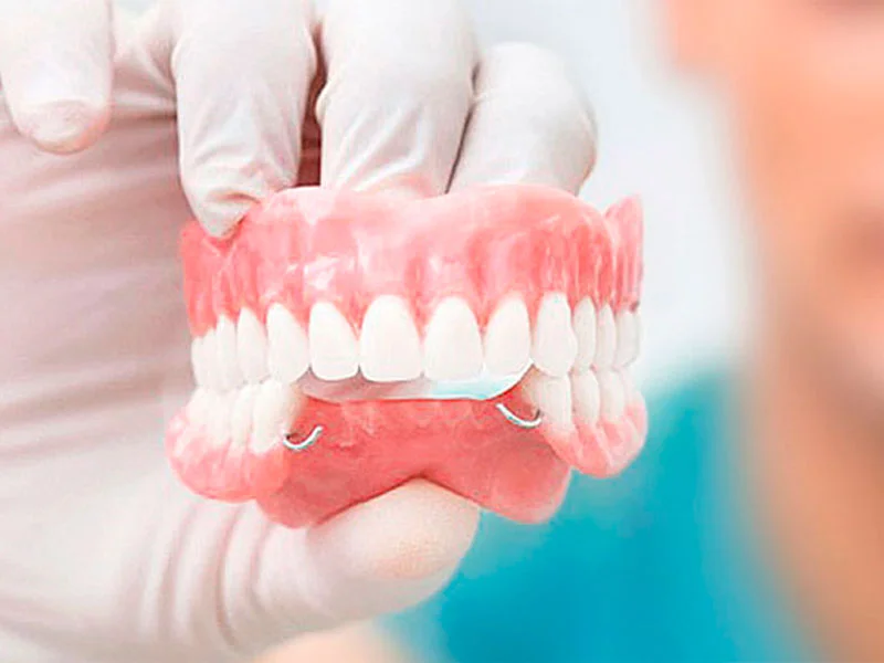 Rehabilitación Oral